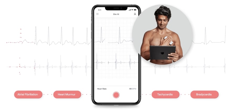 The AI-powered platform from Eko features advanced heart monitors, patient and provider software, and AI-powered reporting.